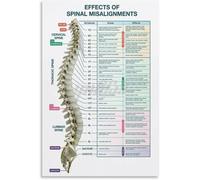 SSOPTMCB Human Spine Anatomy Art Print - Nervous System Diagram Educational Poster - Wall Decor for Chiropractor Office, Clinic & Study Room(Framed,12x18inch(30x45cm))