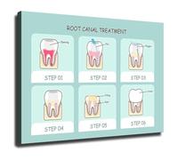 SSOPTMCB Understanding Root Canals Health Educational Poster Oral Anatomy Chart for Clinic(Unframed,16x24inch(40x60cm))