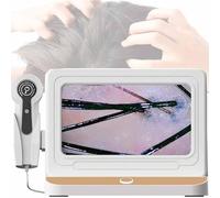 SSQUZA Analizzatore dei Capelli della Pelle, Schermo 11" HD LCD, Lente d'Ingrandimento della Pelle 50x/200x, Foto di Sostegno, Diagnosi del Follicolo Pilifero della Pelle,Gold