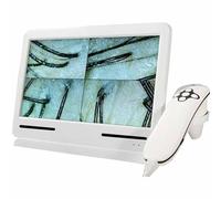 SSQUZA Macchina per L'analisi del Cuoio Capelluto, 10 Pollici Analizzatore Professionale per Capelli E Diagnosi della Pelle 50x/200x Microscopio per Telecamera del Cuoio Capelluto per Salone