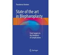 State of the Art in Blepharoplasty: From Surgery to the Avoidance of Complications