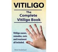 Steve Sunderlan Vitiligo. Vitiligo causes, remedies, costs and treat (Tascabile)