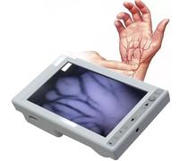 Strumento di visualizzazione delle vene con display venoso e visualizzazione capillare, display LCD con regolazione della luminosità a infrarossi for ospedali e cliniche