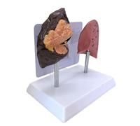 Strumento Dimostrativo Per Polmone Anatomico Del Fumatore E Polmone Sano Sussidio Didattico Clinico In PVC Per Uso In Classe Materiali Formazione Scolastica Clinica