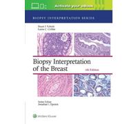 Stuart J Schnit Biopsy Interpretation of the Breast: Print + (Copertina rigida)