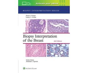Stuart J Schnit Biopsy Interpretation of the Breast: Print + (Copertina rigida)
