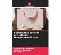 Substituição total da articulação temporomandibular
