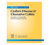 Sunanda V. Kane Francis Mayo Clinic On Crohn's Disease And Ulcerati (Tascabile)