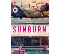 Sunburn