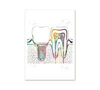 Supkan bstract Dente Implant Strumenti di Bellezza Dentale Wall Art Canvas Painting Nordic Poster e Stampe Immagini a Parete for la Decorazione dell'ospedale(C,40X50 cm Unframed)
