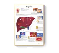 Supkancl Patologia Grafico Anatomia Malattie Poster E Stampe su Tela Pittura Immagini A Parete for Soggiorno Decorazione Complementi Arredo Casa(N,40X50cm No Frame)