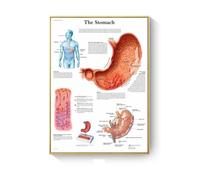 Supkancl Patologia Grafico Anatomia Malattie Poster E Stampe su Tela Pittura Immagini A Parete for Soggiorno Decorazione Complementi Arredo Casa(K,20X25cm No Frame)