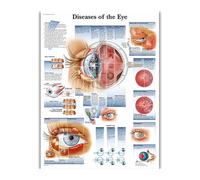 Supkancl Wall Art Anatomia Umana Organi Poster E Stampe Stampate su Tela Dipinti Immagini for La Decorazione Dell'aula della Clinica Ospedaliera(63)