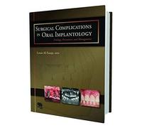 Surgical Complications in Oral Implantology: Etiology, Prevention, and Management