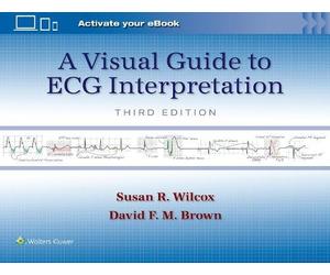 Susan Renee Wilcox A Visual Guide to ECG Interpretation: Print + eBo (Tascabile)
