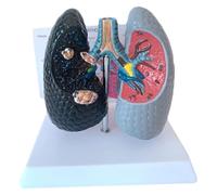 Sussidio didattico for l'anatomia broncopolmonare del modello comparativo dei polmoni del fumo for la salute umana