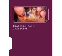 Syed Shahmeer Raza Romana Ayub Diabetic Foot Infection (Tascabile)