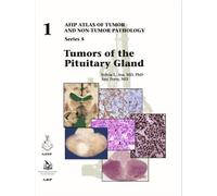 Sylvia L. Asa Arie Perry Tumors of the Pituitary Gland (Copertina rigida)