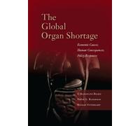 T. Randolph Beard Rigmar Osterkamp David L. The Global Organ (Copertina rigida)