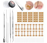 Tagliaunghie Set Professionale, Set per la Correzione Delle Unghie Incarnite, Unghie Incarnite con Patch per la Correzione Delle Unghie, Tagliaunghie, Sollevaunghie, Spingiunghie