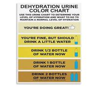 TAMDDBPJD Educational Hydration Guide with Color Chart for Wellness and Private Health Space Wall-Art(Framed,12x18inch(30x45cm))