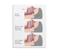 TAMDDBPJD Sleep Apnea Educational Poster Health Awareness Guide Canvas Print Wall-Art for Bedroom Living Room Home Office Decor(Unframed,12x18inch(30x45cm))