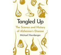Tangled Up: The History and Science of Alzheimer's Disease