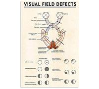 Targhe in metallo con difetti del campo visivo, poster retrò, conoscenza dell'ottico, studio medico, targa educativa, decorazione da parete per casa, clinica e ospedale, 12x16 pollici