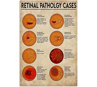 Targhe in metallo con informazioni sull'oftalmologia, poster per casi di patologia retinica, guida per studio oculistico, targa in alluminio, decorazione da parete per ospedale, ufficio e casa, 12x16
