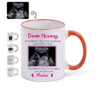 Tazza da caffè personalizzata con foto ecografica del bambino, tazza da caffè personalizzata con foto ecografica e testo, regalo per la festa della mamma e del papà per i futuri genitori 13oz