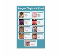 TCM Diagnostic Poster Tongue Examination Chart Acupuncture Clinic Decor | Essential reference for acupuncturists herbalists and holistic health practitioners(Unframed,16x24inch(40x60cm))