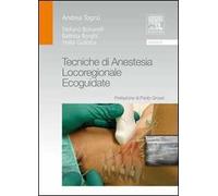 Tecniche di anestesia locoregionale ecoguidate