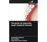 Tecniche di impronta negli impianti dentali