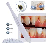 Telecamera Dentale Intraorale WIFI HDMI ad Alta Definizione da 17 Pollici