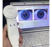 Telecamera iridoscopica medicale,Analizzatore Dell'iride Iridologia,USB iridoscopio Telecamera iridologica,Iris Software per diagnosi Eye