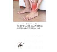 TENDINOPATHIE CALCANÉENNE: ASPECTS CLINIQUES ET ÉCHOGRAPHIQUES