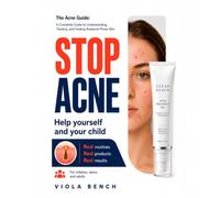 The Acne Guide: A Complete Guide to Understanding, Treating, and Healing Breakout-Prone Skin: Dermatology-Based Skincare Routines, Product Guidance, ... - for Teens, Adults, and During Pregnancy