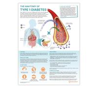 The Anatomy of Type 1 - Poster per diabete di tipo 1, 45 x 60 cm, 18 x 24 pollici, diagramma del diabete mellito di tipo 2