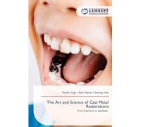 The Art and Science of Cast Metal Restorations: from function to aesthetic