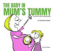 THE BABY IN MUM'S TUMMY: A STORY ON MUM'S CAESAR SURGERY: 45