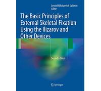 The Basic Principles of External Skeletal Fixation Using the Ilizarov and Other Devices