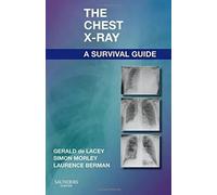 The Chest X-Ray: A Survival Guide di Gerald De Lacey Simon Morley...