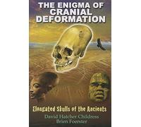 The Enigma of Cranial Deformation: Elongated Skulls of the Ancients