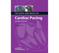 The Nuts and Bolts of Cardiac Pacing