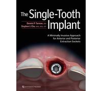 The Single-Tooth Implant: A Minimally Invasive Approach for Anterior and Posterior Extraction Sockets