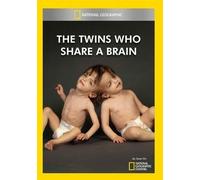 The Twins Who Share A Brain (DVD)
