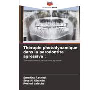 Thérapie photodynamique dans la parodontite agressive :: Therapeis dans la parodontite agressive