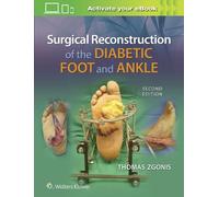 Thomas Zgonis Surgical Reconstruction of the Diabetic Foot an (Copertina rigida)