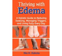 Thriving with Edema: A Holistic Guide to Reducing Swelling, Managing Triggers, and Living Fully Every Day