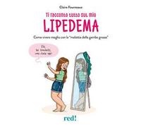 Ti racconto tutto sul mio lipedema. Come vivere meglio con la «malattia delle gambe grosse»